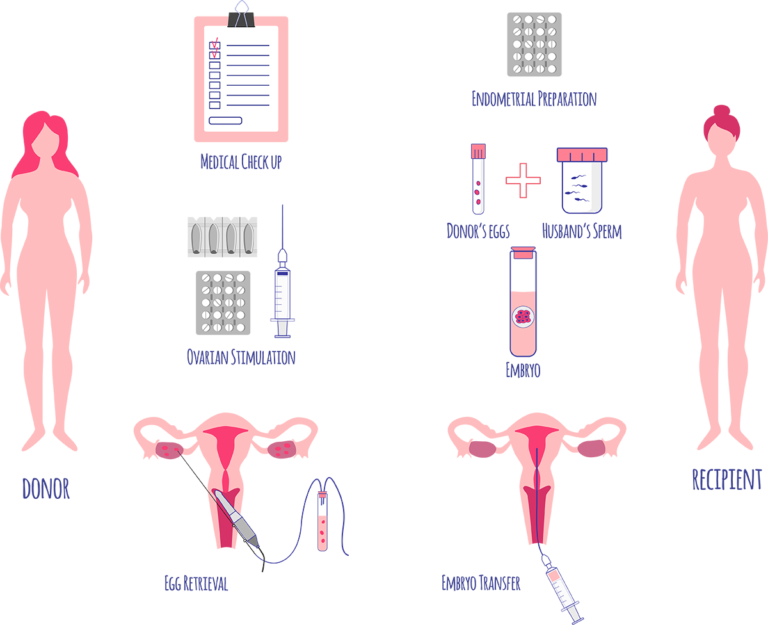 Donor egg ivf outlet